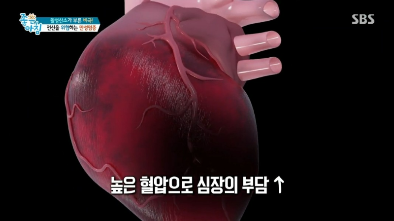 만성 염증 과 질환