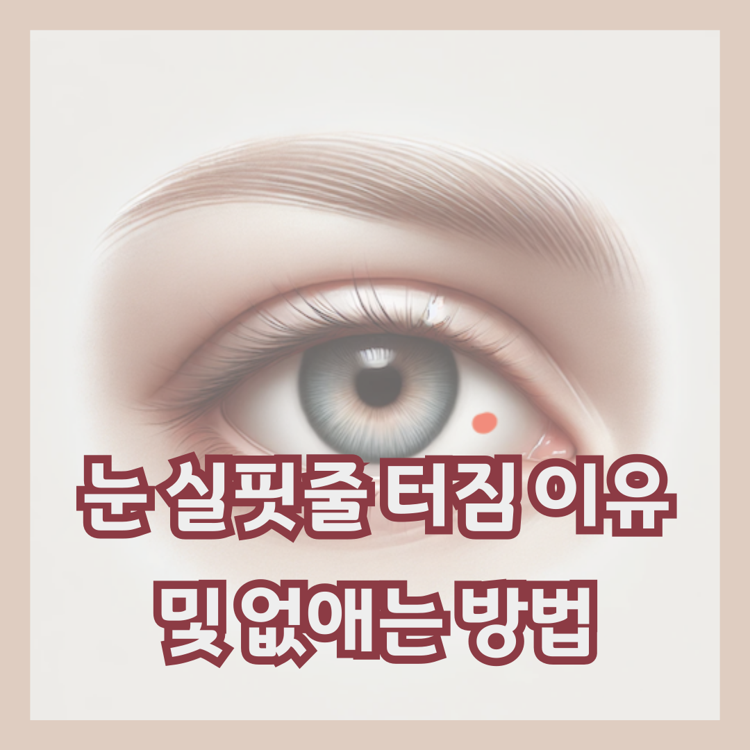 눈실핏줄터짐-이유