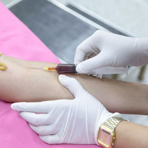 치매 예방약 처방 - 혈액 검사