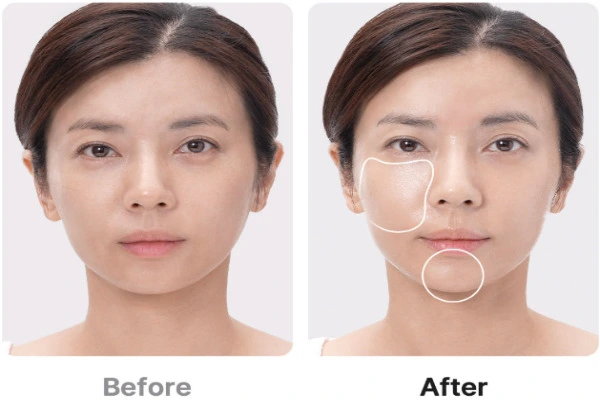 메디큐브 부스터프로 내돈내산 솔직 후기