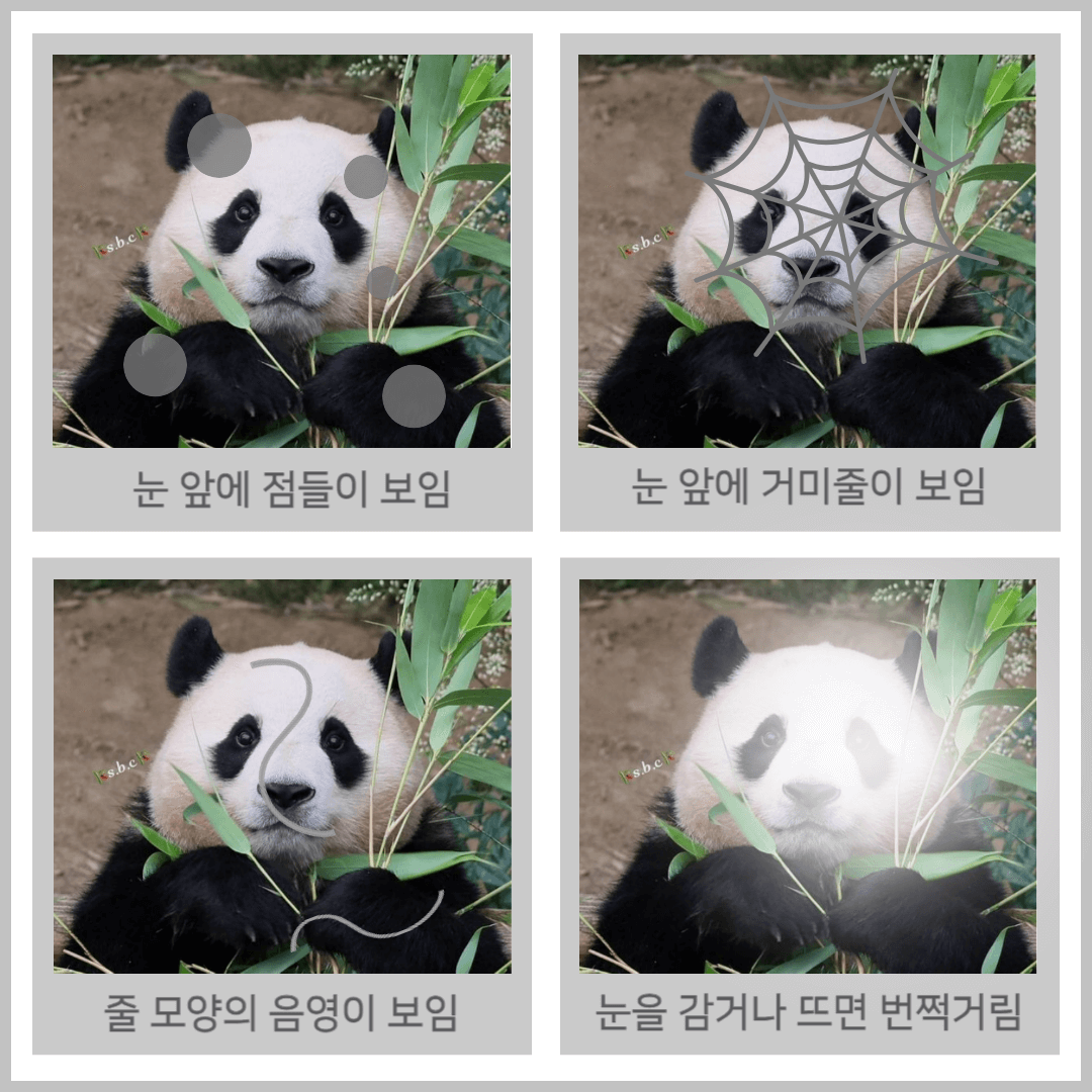 비문증 증상
