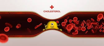 총콜레스테롤 정상수치