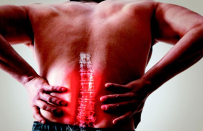 허리디스크로 고통을 받는 남자의 사진