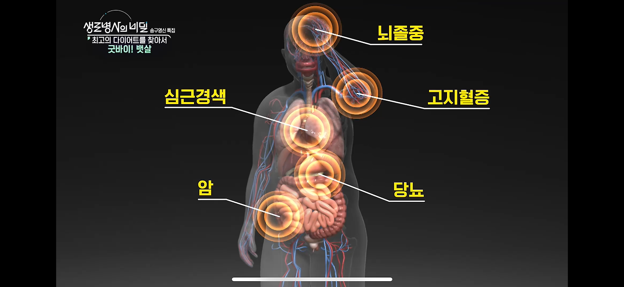 생로병사의 비밀 다이어트 굿바이 뱃살