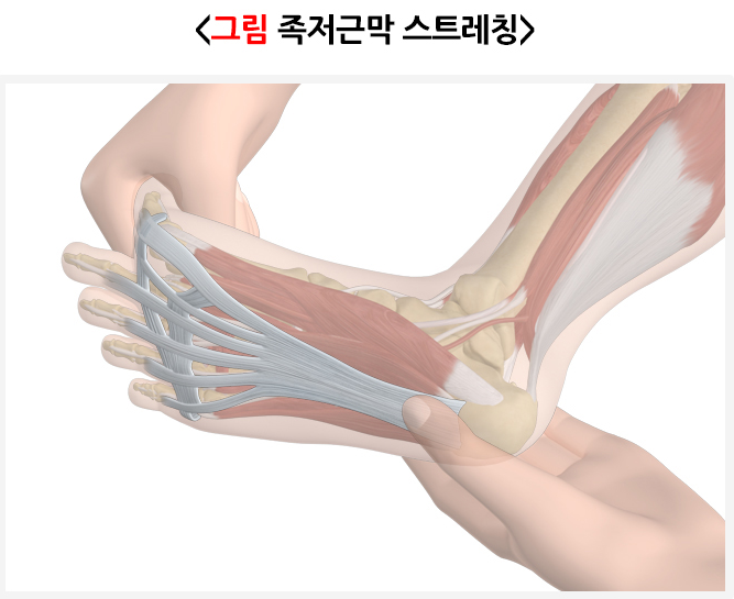 족저근막 스트레칭 관련 이미지