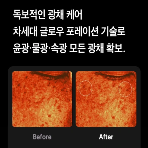 메디큐브 부스터프로 내돈내산 후기
