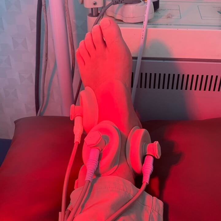 인대부분 저주파 물리치료 사진