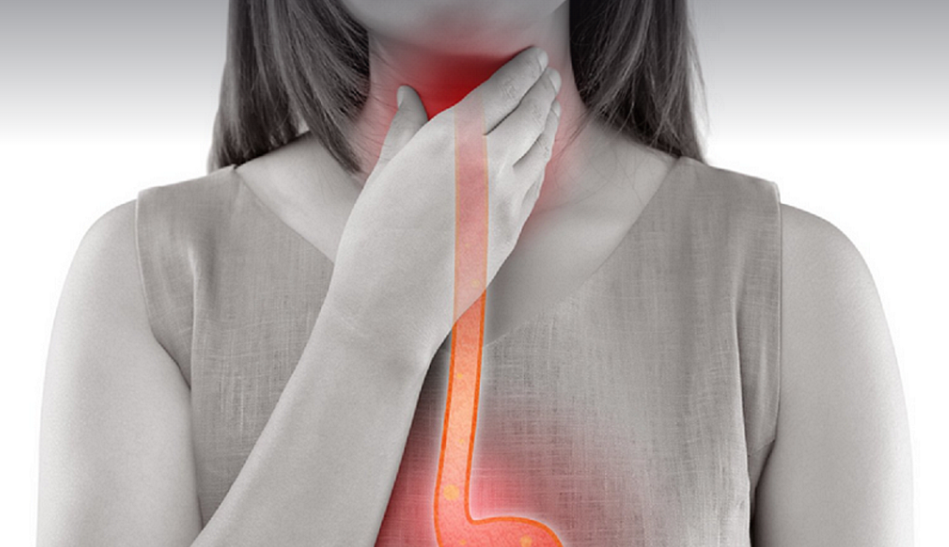 케이캡정 50mg 효능, 부작용, 주의사항