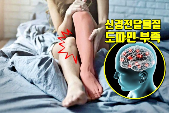 하지불안증후군 증세 원인, 철분 부족, 건강
