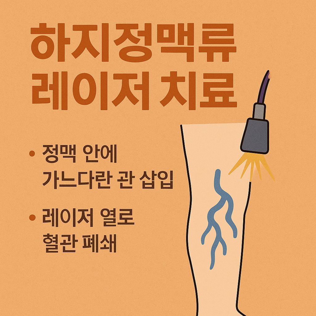 하지정맥류