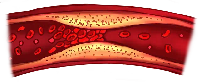 고지혈증 관련사진1