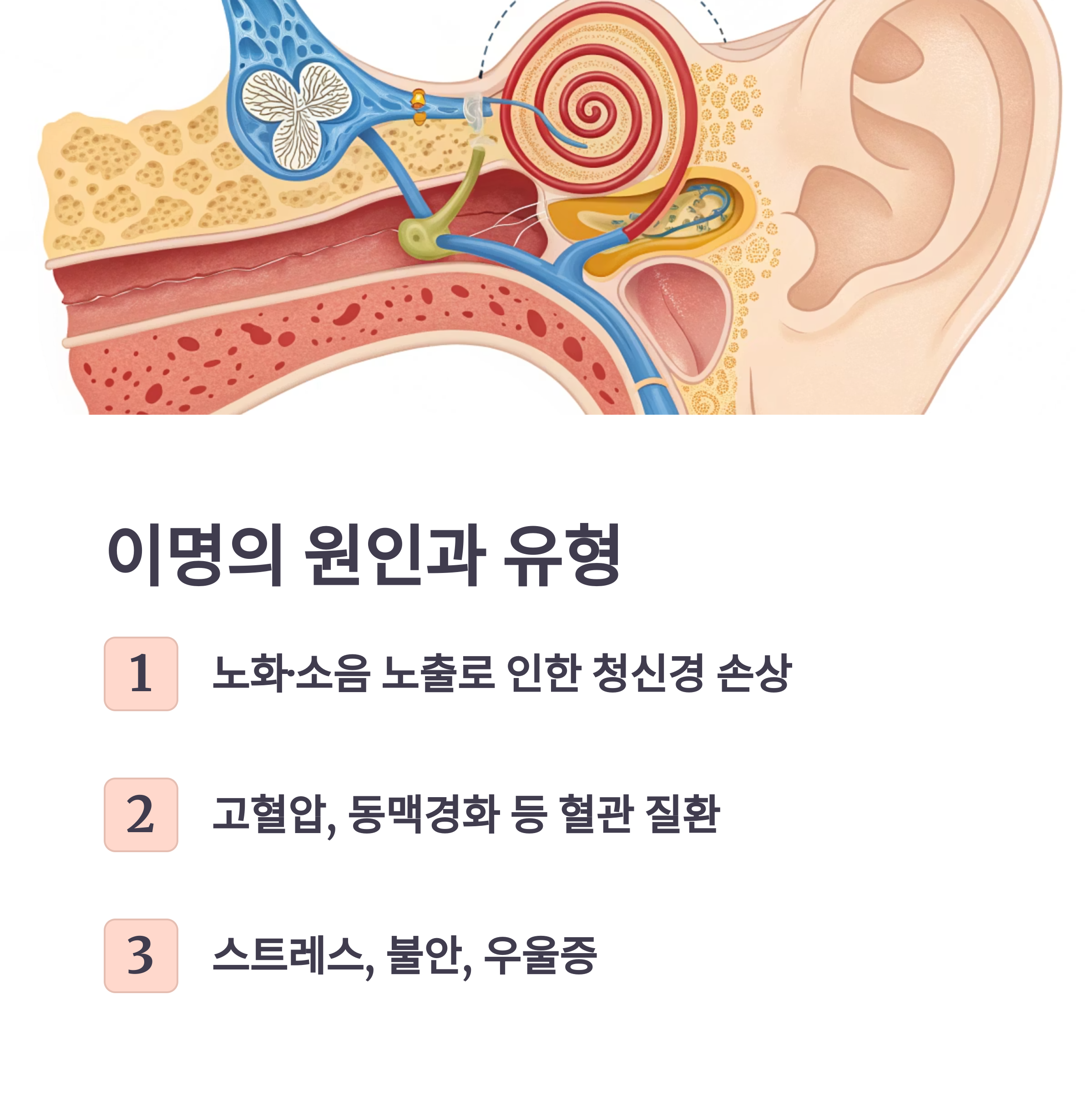 이명의 원인과 유형