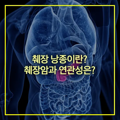췌장 낭종 췌장암 연관성