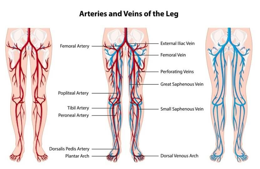 다리 혈관을 비교해주는 사진