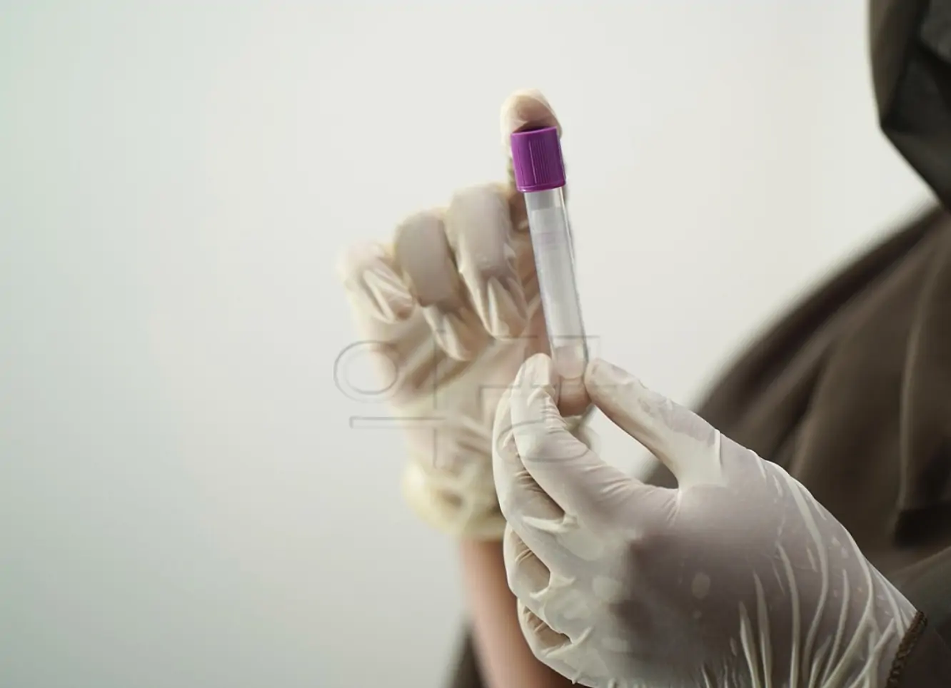 음식물 과민증 검사 비용 관련 사진