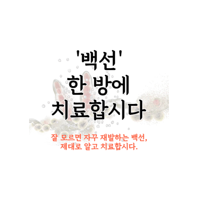 백선-치료