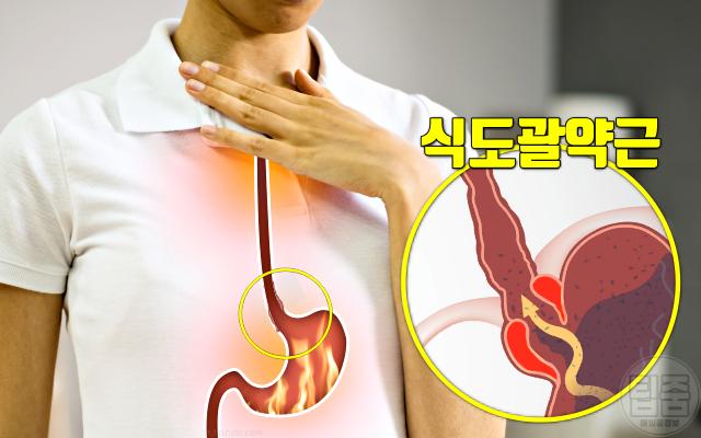 커피 마시면 안되는 사람 커피 하루 권장량 역류성식도염