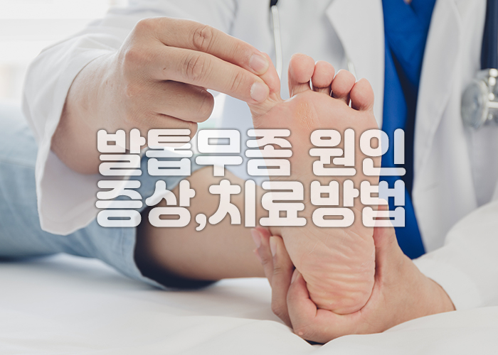 의사가 발톱무좀을 치료하기 위해 발톱을 살펴보고 있다