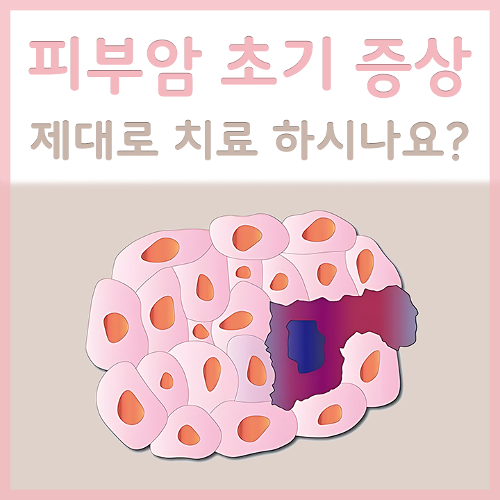 피부에-발생한-암의-모습