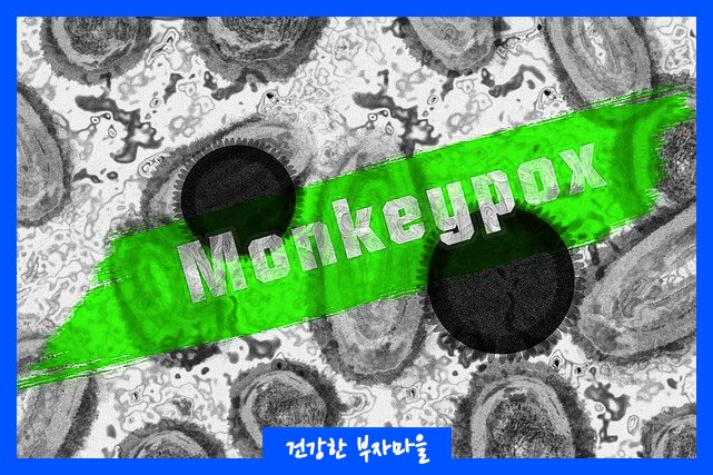 원숭이두창 백신현황