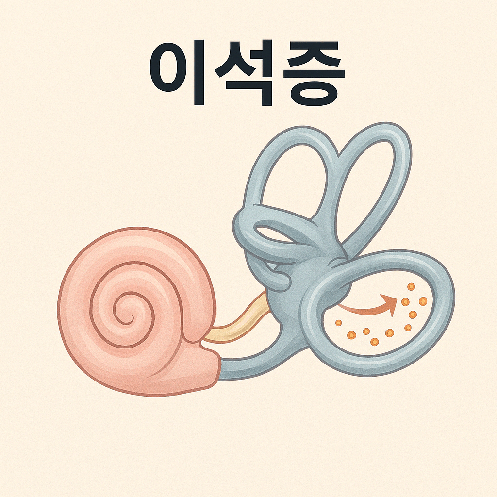 이석증 원인 증상 및 치료법 자가진단 방법