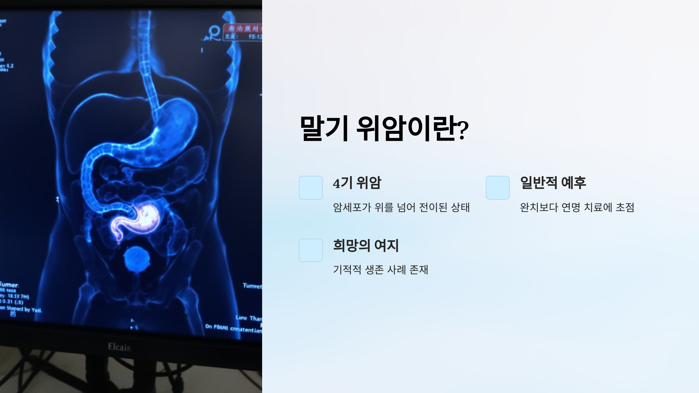 말기 위암이란?