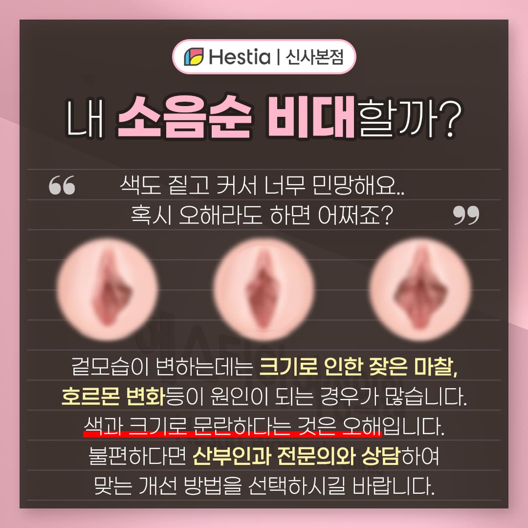 내 소음순 비대 할까?