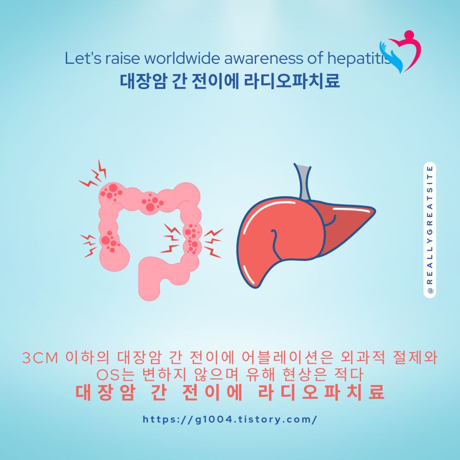 대장암 간 전이에 라디오파치료
