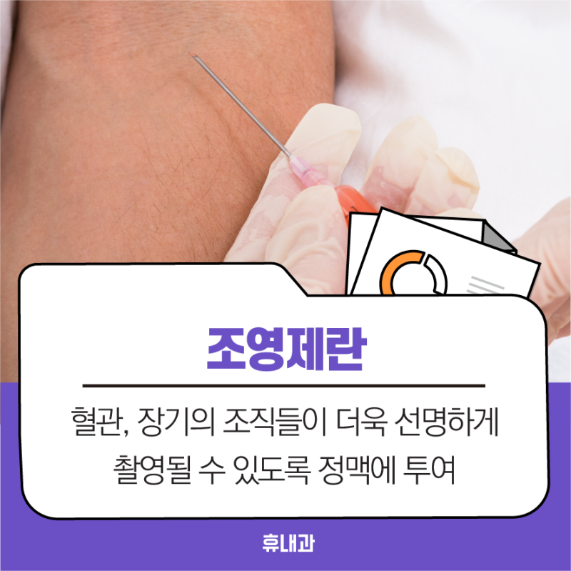 조영제