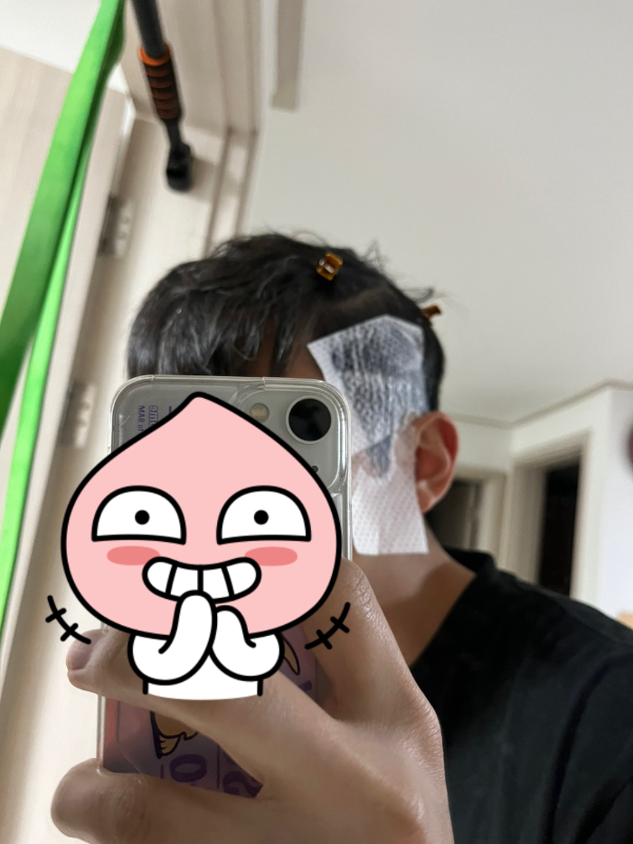 1회용 파마지 붙인 모습