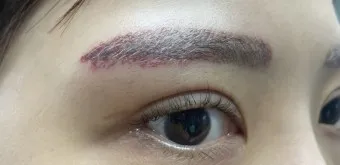 눈썹 문신 제거 방법 꿀팁_9