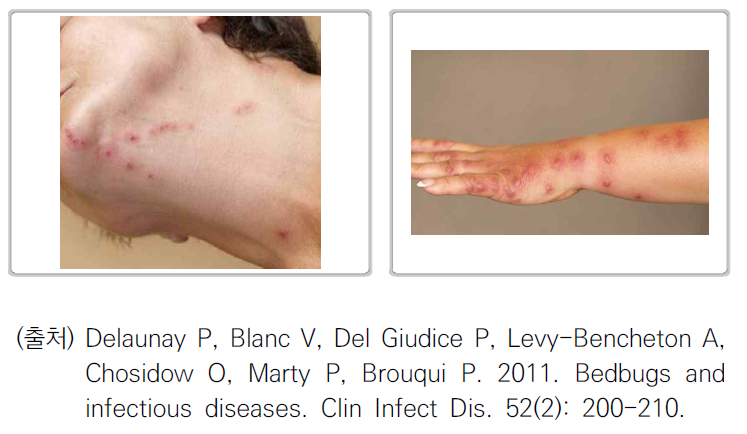 서울시 빈대 예방 및 관리 안내서