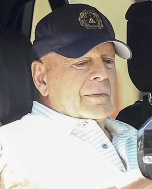 브루스 윌리스 전두측두엽 치매(FTD)란? 치명적인 특징