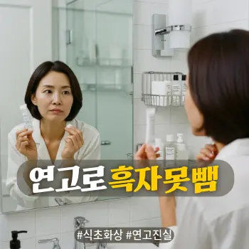 * 이미지 프롬프트: #모던 #미니멀 #깨끗한 #자연광 키워드를 반영한 디자인. 화사하고 정돈된 화이트 톤의 파우더룸. 40대 한국인 여성이 한 손에는 작은 연고 튜브나 면봉을 들고, 거울 속 자신의 얼굴을 보며 바를지 말지 망설이거나 의심스러운 눈초리로 연고를 쳐다보는 모습. "이게 정말 효과가 있을까?"라고 고민하는 진지한 표정. 인위적인 피부 보정 없이 자연스러운 피부 결이 살아있는 아날로그 필름 사진 스타일의 고화질 실사.
* 썸네일 텍스트(제목): 연고로 흑자 못 뺌
* 해시태그: #식초화상 #연고진실