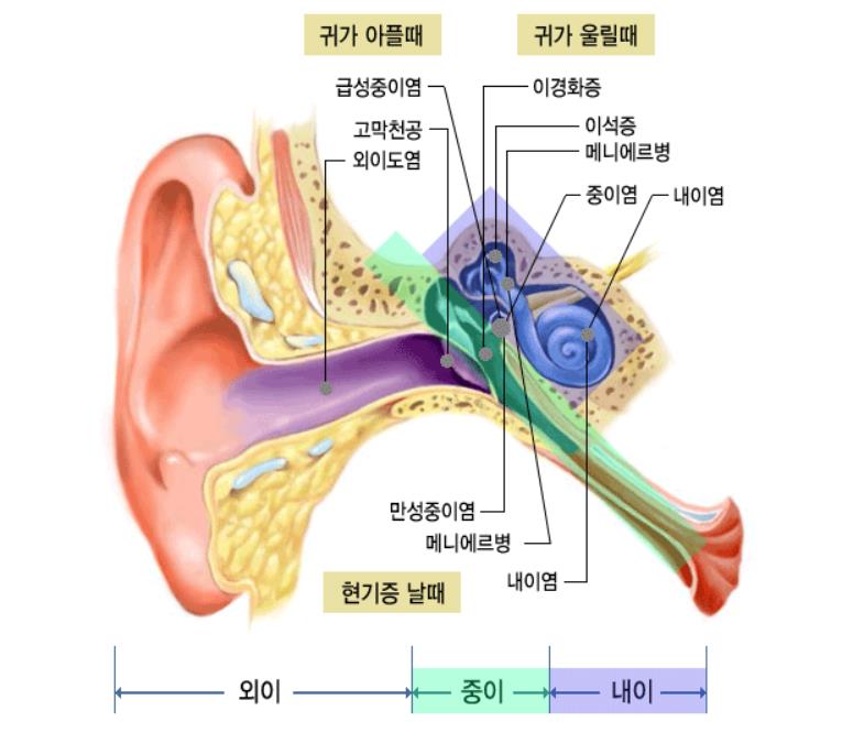 외이도염