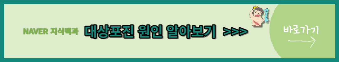 대상포진 (3)