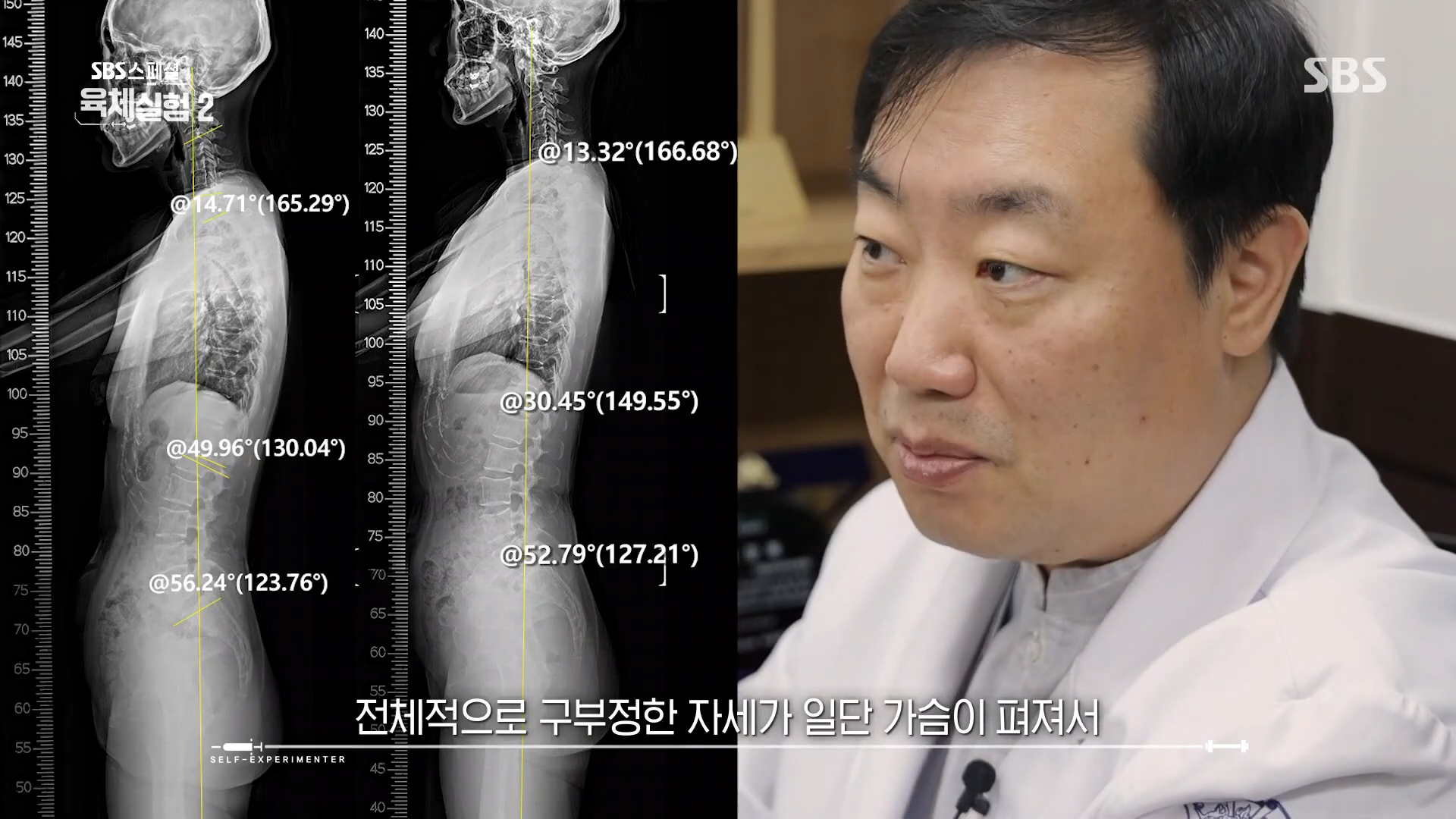 거북목 알림 진동 기계 힐디넥 에그 SBS 스페셜 육체실험 바른 자세