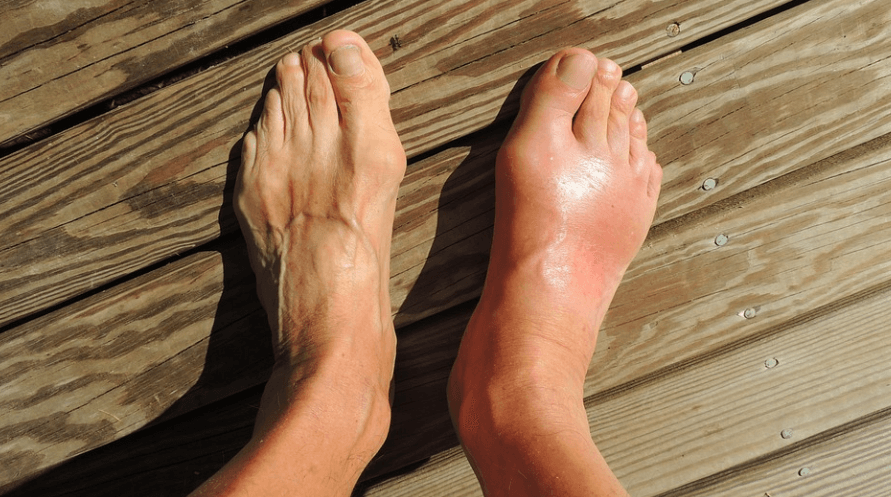 발을 찍은 사진 - 44