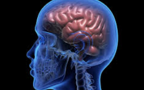 뇌동맥류 초기 증상