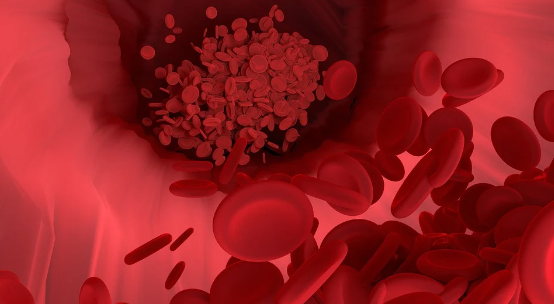 고지혈증 영양제 추천