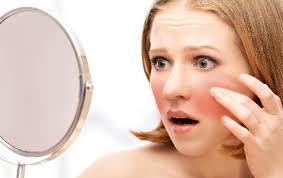 루프스 관련 사진