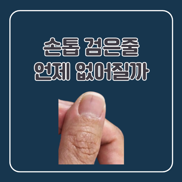 손톱 밑 검은줄 없어지는 기간