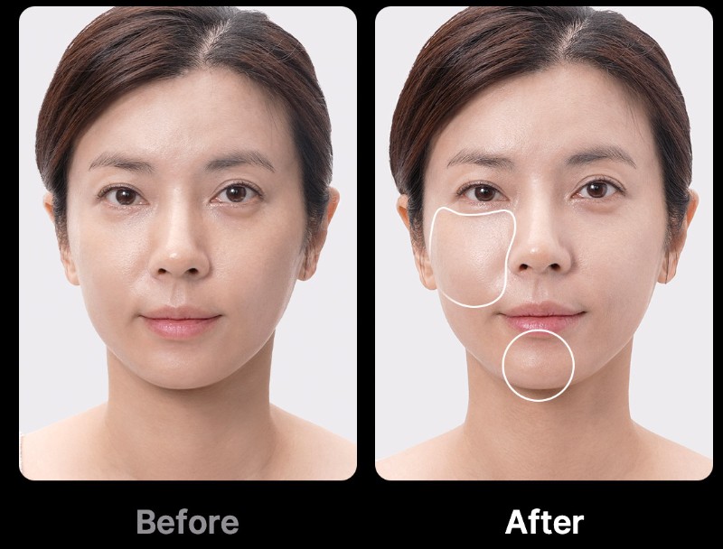 메디큐브-부스터프로-효과-사용법-3