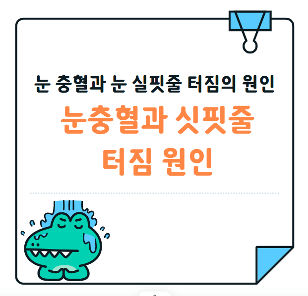 눈 충혈과 눈 실핏줄 터짐의 원인과 관리 방법 총정리!