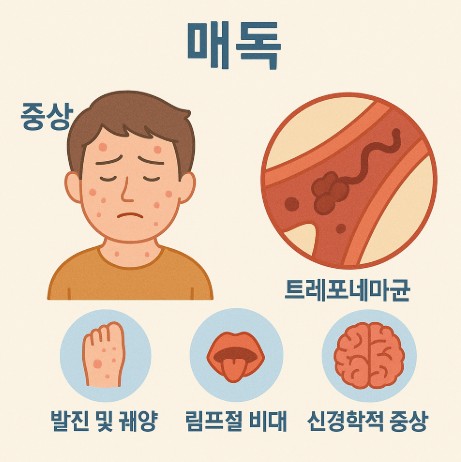 매독