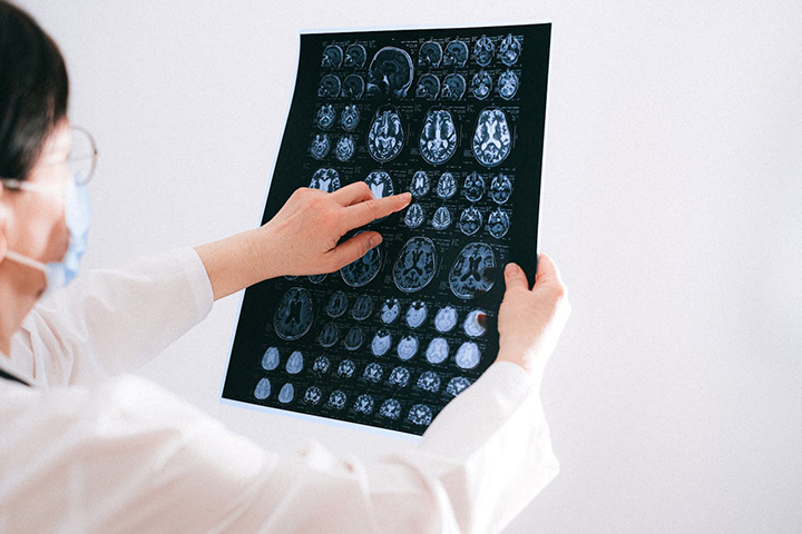 뇌-사진을-보는-의사