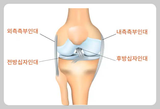 전방십자인대파열 증상