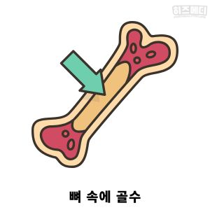 빈혈 원인 만성 질환