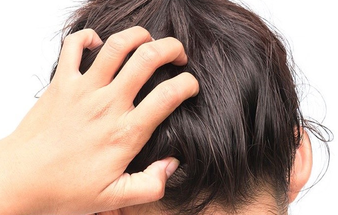 뒷쪽머리를-긁는-여성