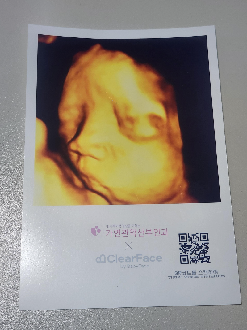 35주 초음파사진